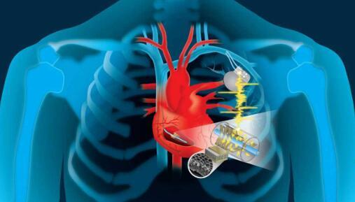 从心脏运动中获取能量的设备可以为植入式设备提供动力